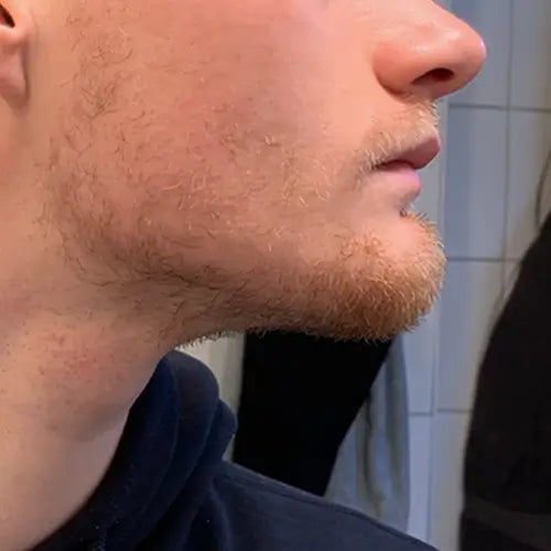 Bart voordat hij de finez baardgroei kit heeft gebruikt.