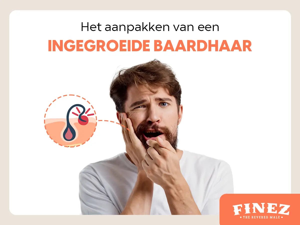 Ingegroeide Baardharen Aanpakken: Van Irritatie tot Preventie - Finez